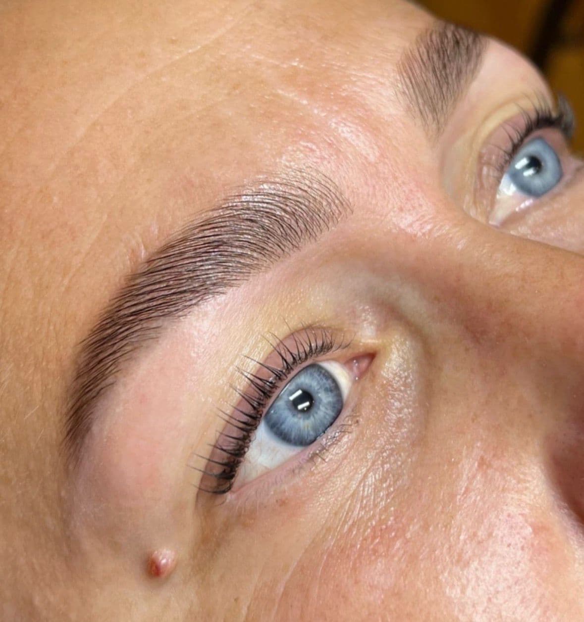 Browlift sourcils
